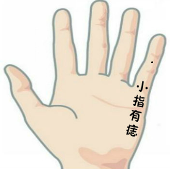 中指长痣代表什么（女人左手中指突然长痣）-6