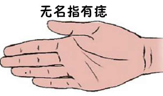 大拇指有痣是什么意思（大拇指有痣图解）-5
