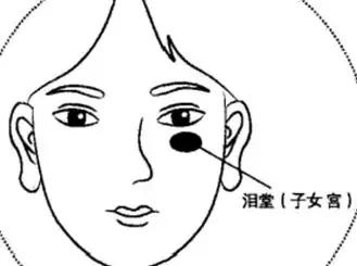 眼睛的痣代表什么意思（眼睛上有痣图解）-1