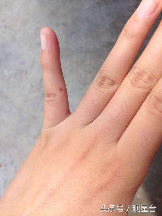 左手无名指有痣的女人代表什么意思（一分钟看懂女人左手无名指有痣全图解）