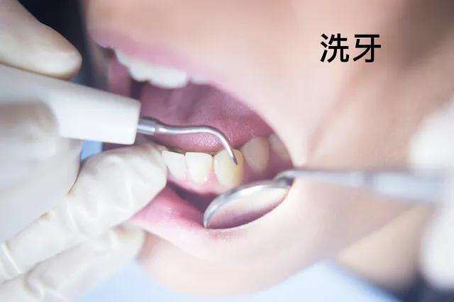 女生牙齿数量多少正常图解（一文分析正常成年女性牙齿数量）