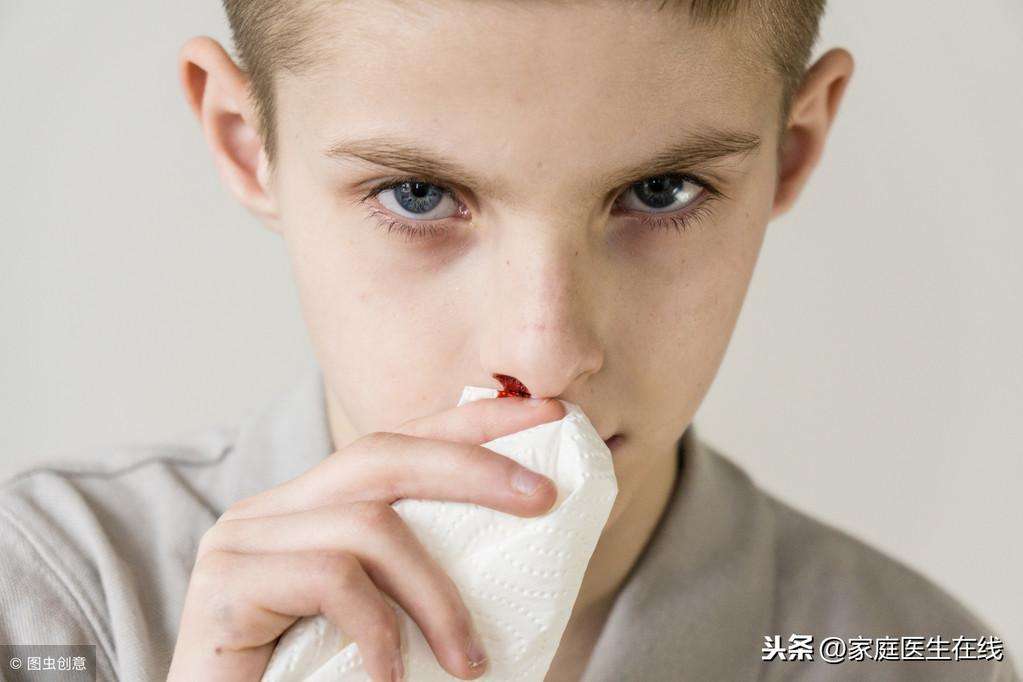小孩经常流鼻血是什么原因（4个原因可以解释清楚）
